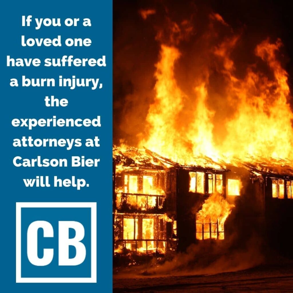Attorneys for Burn Injuries | Carlson Bier Associates LLC