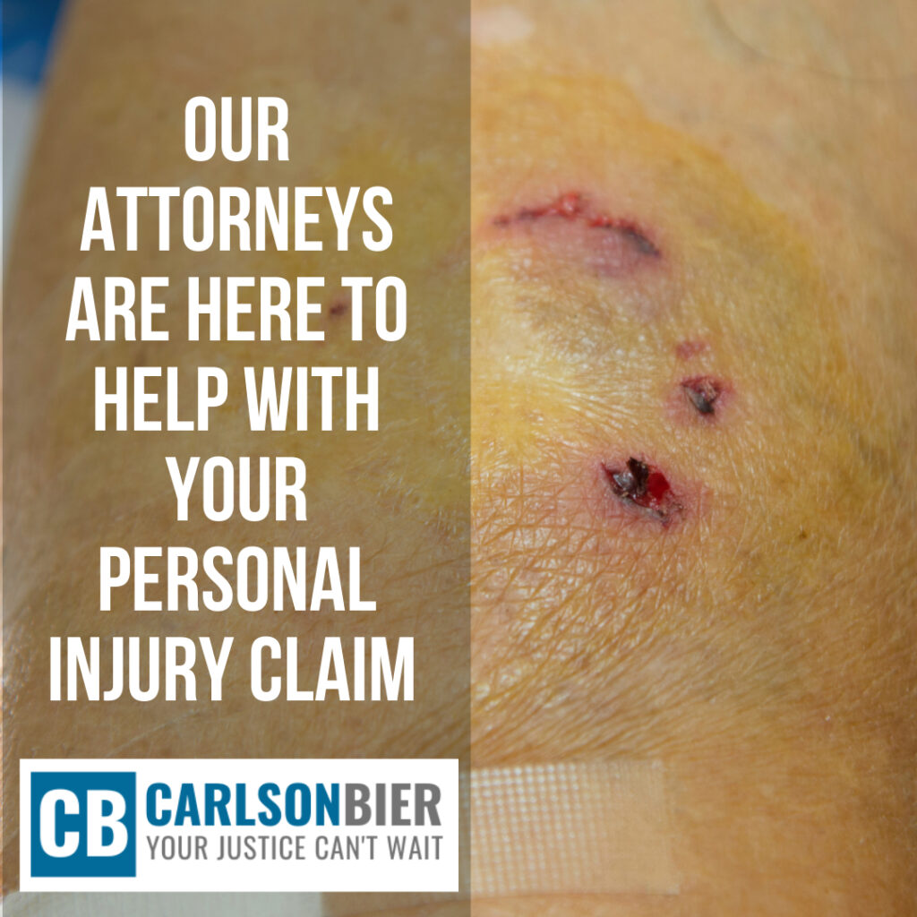 Personal Injury Lawyer Aurora Illinois | Carlson Bier Associates